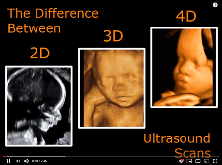 Comparing-ultrasound1